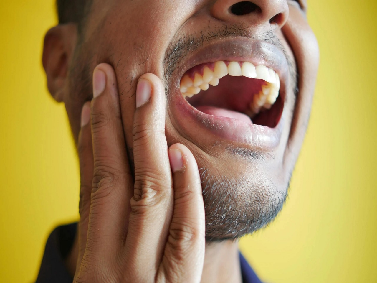 Gingivitis